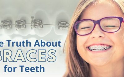 The Truth About Braces for Teeth