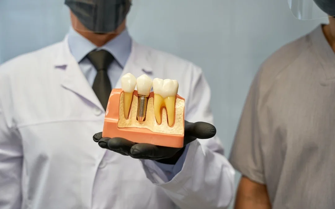 The Pros And Cons Of Dental Implants