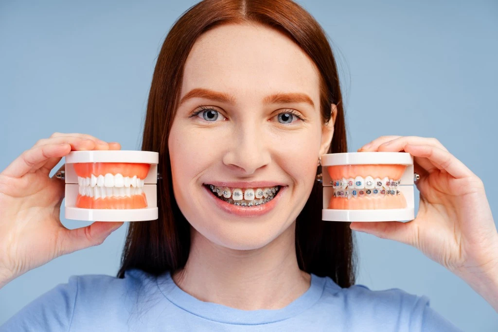 Braces vs. Invisalign - Hygiene Differences